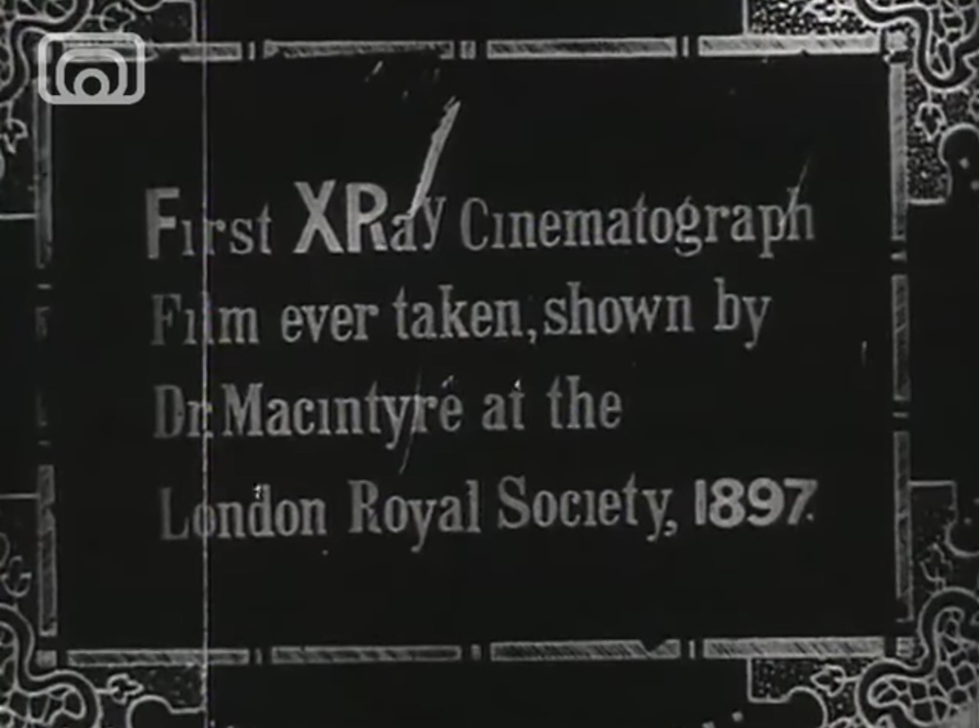 1st X ray cinematihograph