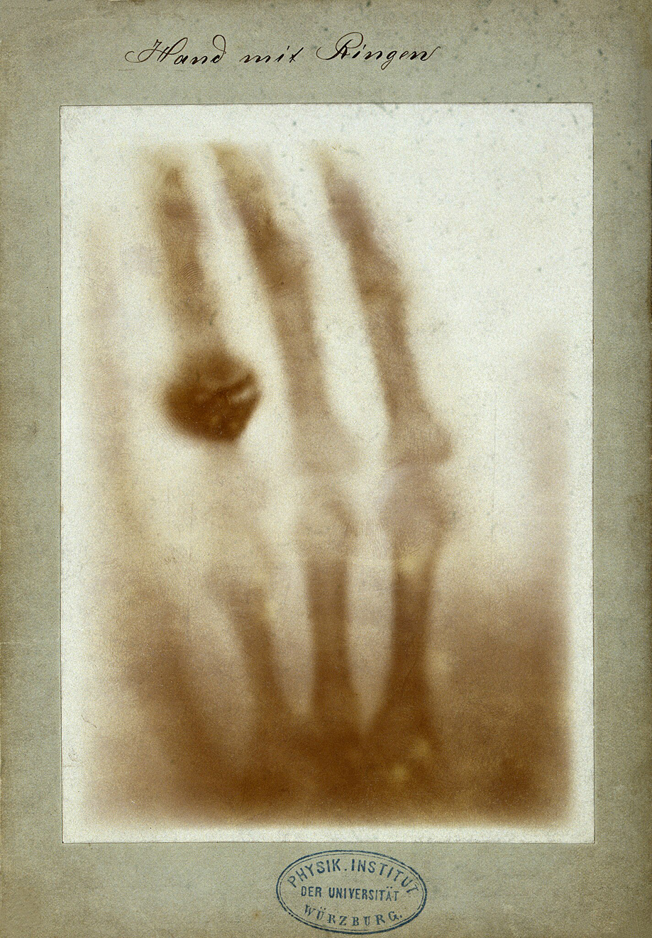 First medical X ray by Wilhelm Roentgen of his wife Anna Bertha Ludwigs hand   18951222
