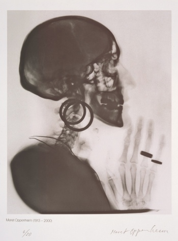 preview Meret Oppenheim Roentgenaufnahme des Schaedels bern 17823