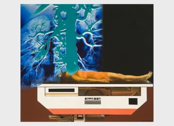 preview Rozanskaite X Ray Inv. Nr. Roz T0802